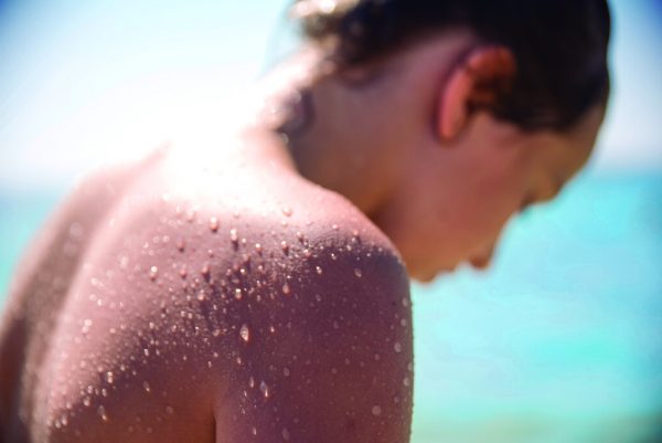 Καρκίνος του δέρματος: Τελικά το μελάνωμα δεν είναι η πιο φονική μορφή