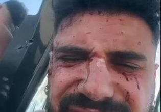 Ισραήλ: 28χρονος περιγράφει πώς επέζησε από τη σφαγή στο μουσικό φεστιβάλ