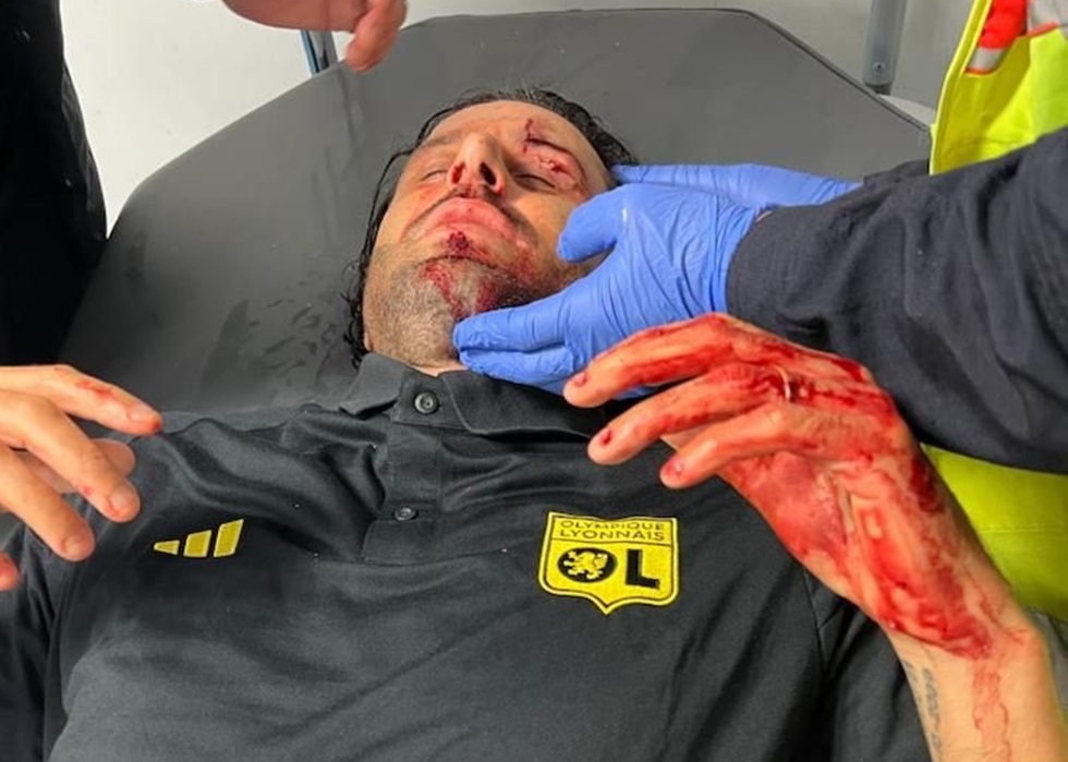 Τραυματίστηκε ο Γκρόσο μετά από επίθεση οπαδών της Μαρσέιγ στο πούλμαν της Λιόν - Αιμόφυρτος ο Ιταλός κόουτς