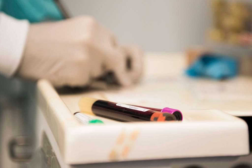 Καρκίνος: «Υπερευαίσθητο» τεστ αίματος ανιχνεύει βιοδείκτη πολλών κοινών όγκων