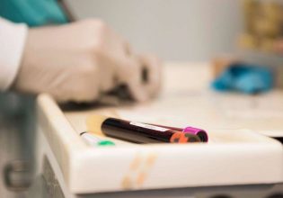 Καρκίνος: «Υπερευαίσθητο» τεστ αίματος ανιχνεύει βιοδείκτη πολλών κοινών όγκων