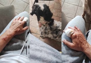 Ηγουμενίτσα: Στο νοσοκομείο μετά από επίθεση πίτμπουλ – Τη δάγκωσε στα δύο χέρια