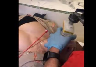 Θεσσαλονίκη: Τα κρίσιμα δευτερόλεπτα που έσωσαν 39χρονη μετά από δάγκωμα οχιάς – Συγκλονιστικό βίντεο