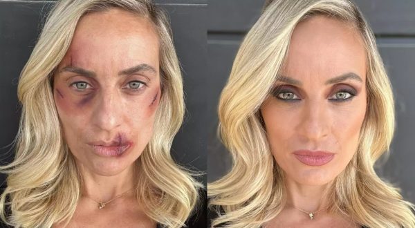 Συγκλονίζει η Ελεονώρα Μελέτη για την κακοποίηση: «Μήπως έχεις υπάρξει κι εσύ θύμα;»