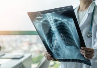 Μάχη με τον καρκίνο – Πόσες φορές οι γιατροί ακούν το αίτημα για ευθανασία