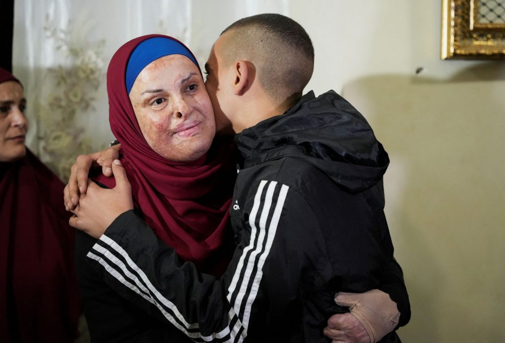 Ανάμεσα στους Παλαιστίνιους που απελευθερώθηκαν εγκαυματίας – Επιδρομή Ισραηλινών στο σπίτι της