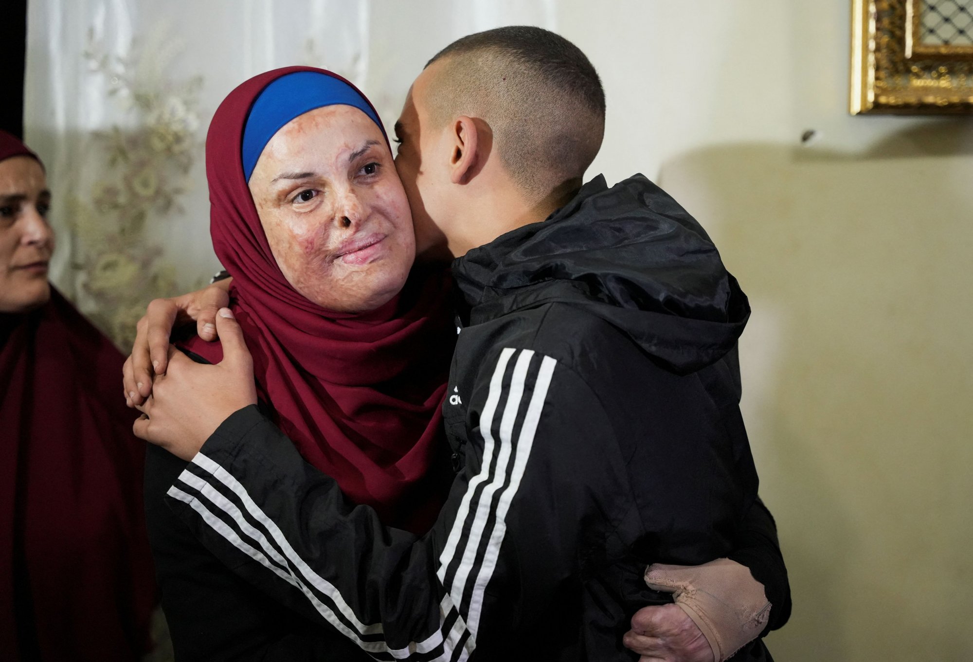 Ανάμεσα στους Παλαιστίνιους που απελευθερώθηκαν εγκαυματίας - Επιδρομή Ισραηλινών στο σπίτι της