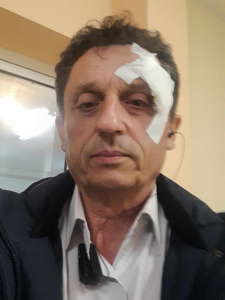 Αποκλειστικά στο in: Τι είπε ο Δήμαρχος Αλιάρτου – Θεσπιέων για τον σοβαρό τραυματισμό του