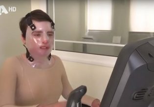 «Μου έδιναν 5% πιθανότητες να ζήσω» – Πήγε να ανάψει τη σόμπα και τυλίχτηκε στις φλόγες