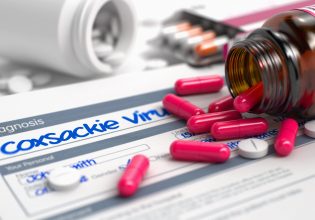 Iός κοξάκι: Πώς μεταδίδεται – Τι συμβουλές δίνει η Ματίνα Παγώνη