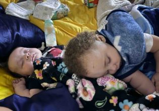 ΗΠΑ: Μωρό βρέθηκε ζωντανό σε δέντρο αφού παρασύρθηκε από ανεμοστρόβιλο – «Σαν να το έβαλε άγγελος»