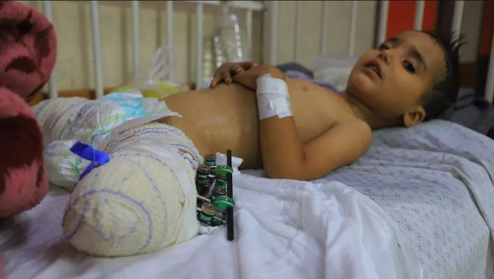 Γάζα: «Έκλαιγε και φώναζε συνεχώς τη νεκρή μαμά της» - Το δράμα των τραυματισμένων ορφανών