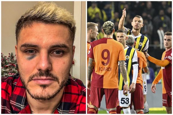 «Βράζουν» με τη διαιτησία: Με μαυρισμένο μάτι τελείωσε το ντέρμπι ο Ικάρντι! (vid)