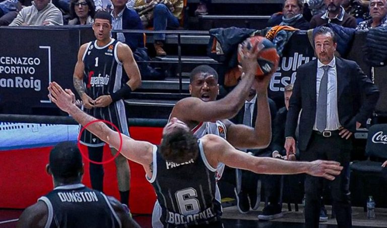 Ο Παγιόλα της Βίρτους έχασε… το δόντι του μετά απο αγκωνιά του Ίνγκλς (pic, vid)