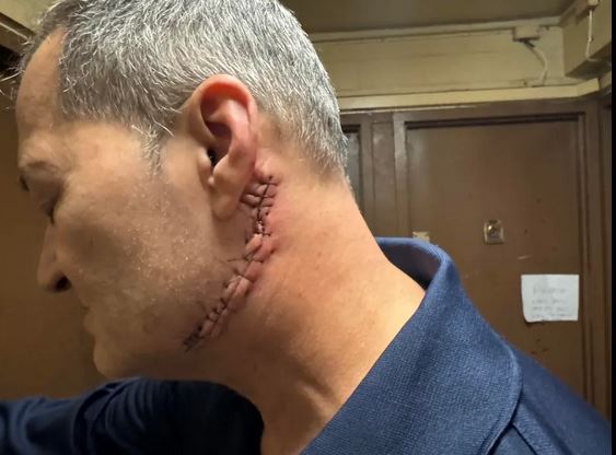 ΗΠΑ: Ουρούσε σε αυτοκίνητο και έκοψε το λαιμό άντρα που του έκανε παρατήρηση