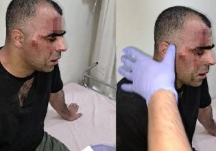 Τουρκία: Ξυλοκόπησαν άγρια δημοσιογράφο και τελικά καταδικάστηκε ο ίδιος για «προσβολή» των δραστών