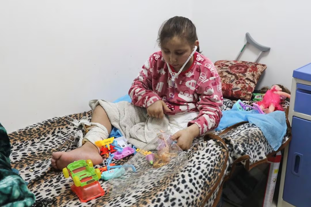 Γάζα: Περισσότερα από 10 παιδιά κάθε μέρα ακρωτηριάζονται στα πόδια - Κάποιες φορές χωρίς νάρκωση