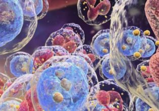 Νέος έλεγχος του FDA σε καινοτόμες θεραπείες για δευτερογενή καρκίνο στο αίμα