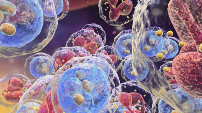 Νέος έλεγχος του FDA σε καινοτόμες θεραπείες για δευτερογενή καρκίνο στο αίμα