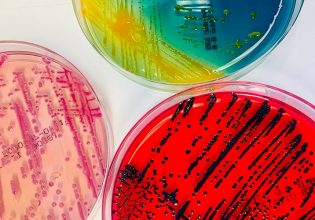 Δεκάδες άγνωστα βακτήρια ανακαλύφθηκαν σε ασθενείς νοσοκομείου