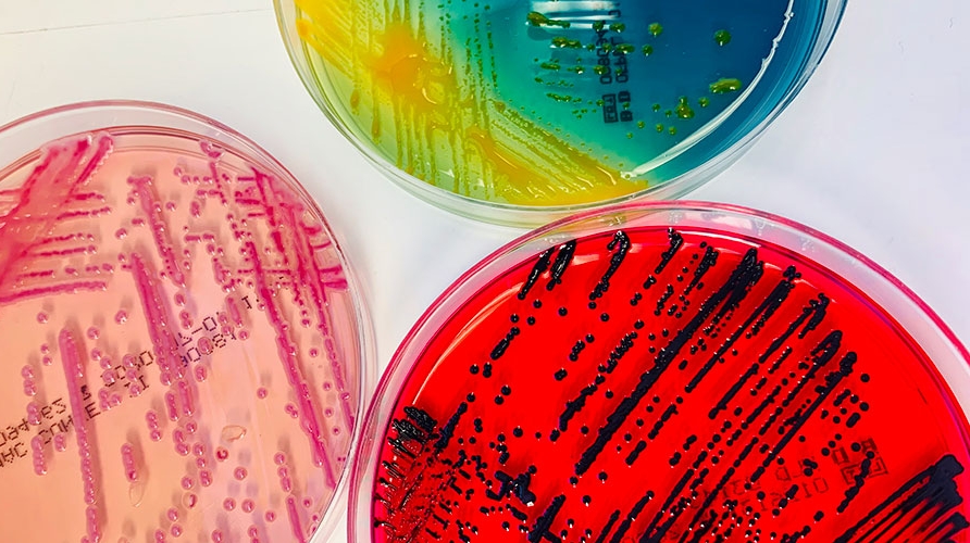 Δεκάδες άγνωστα βακτήρια ανακαλύφθηκαν σε ασθενείς νοσοκομείου