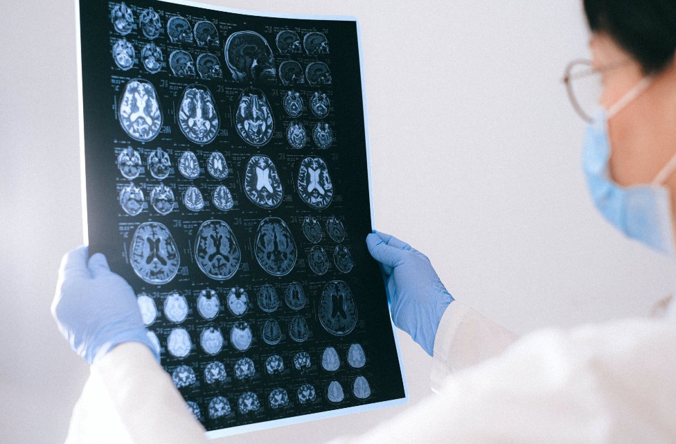 Επιστήμονες ανακάλυψαν τρόπο επιδιόρθωσης της μνήμης στους ασθενείς με Αλτσχάιμερ