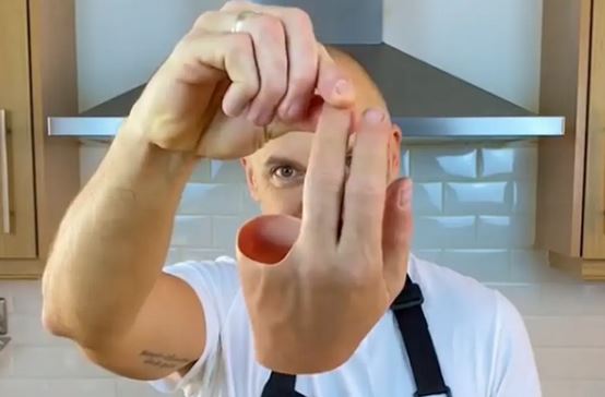 Έχασε τα δάχτυλά του σε φρικιαστικό ατύχημα και φοράει ρεαλιστικό προσθετικό μέλος 12.000 δολαρίων