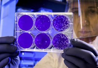 Klebsiella pneumoniae: Προειδοποίηση για θανατηφόρο ανθεκτικό βακτήριο που εξαπλώνεται στην Ευρώπη