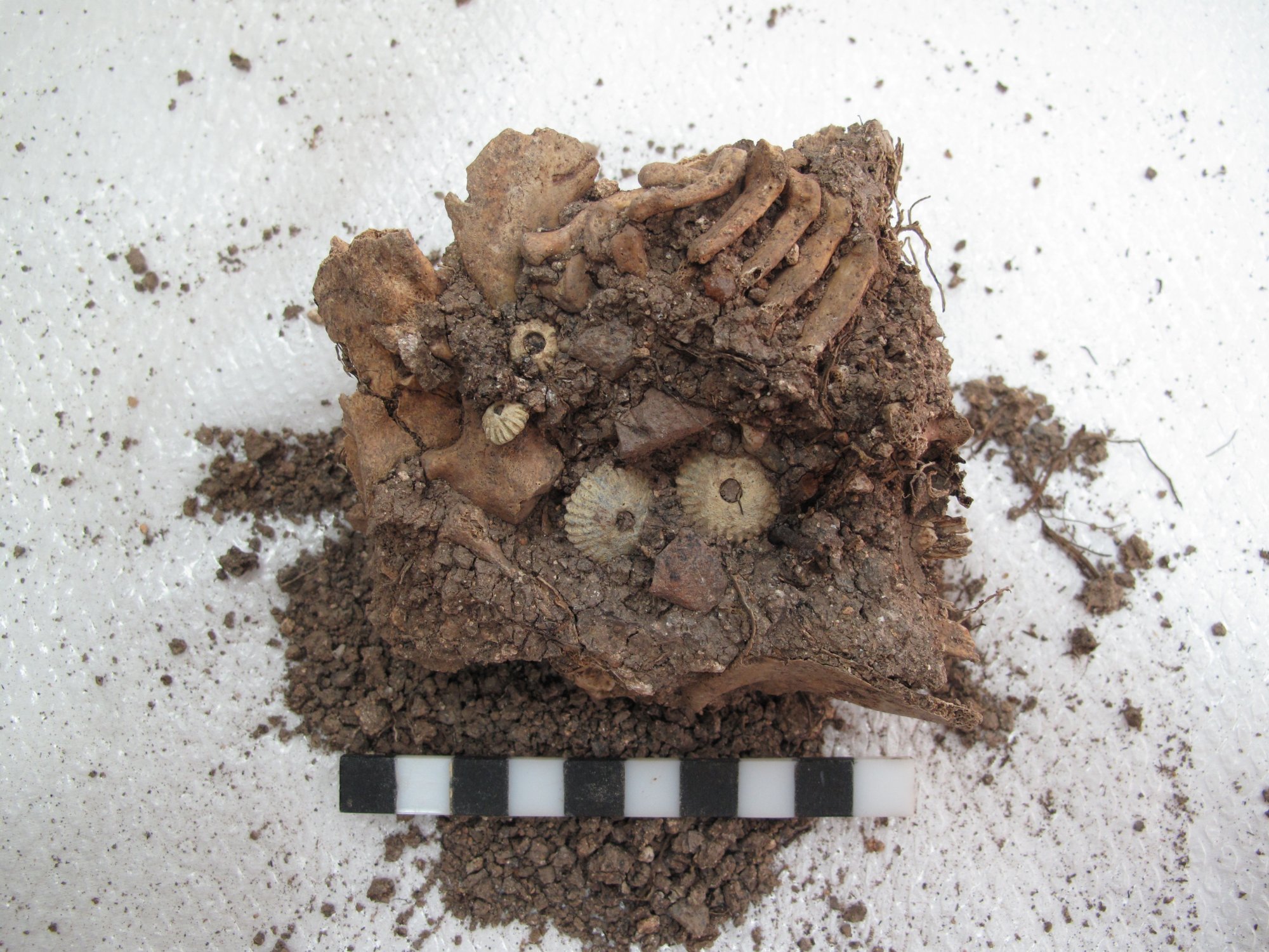 Αίγινα: Σκελετό μωρού με σύνδρομο Down στην Αρχαία Ελλάδα έφερε στο φως ανασκαφή