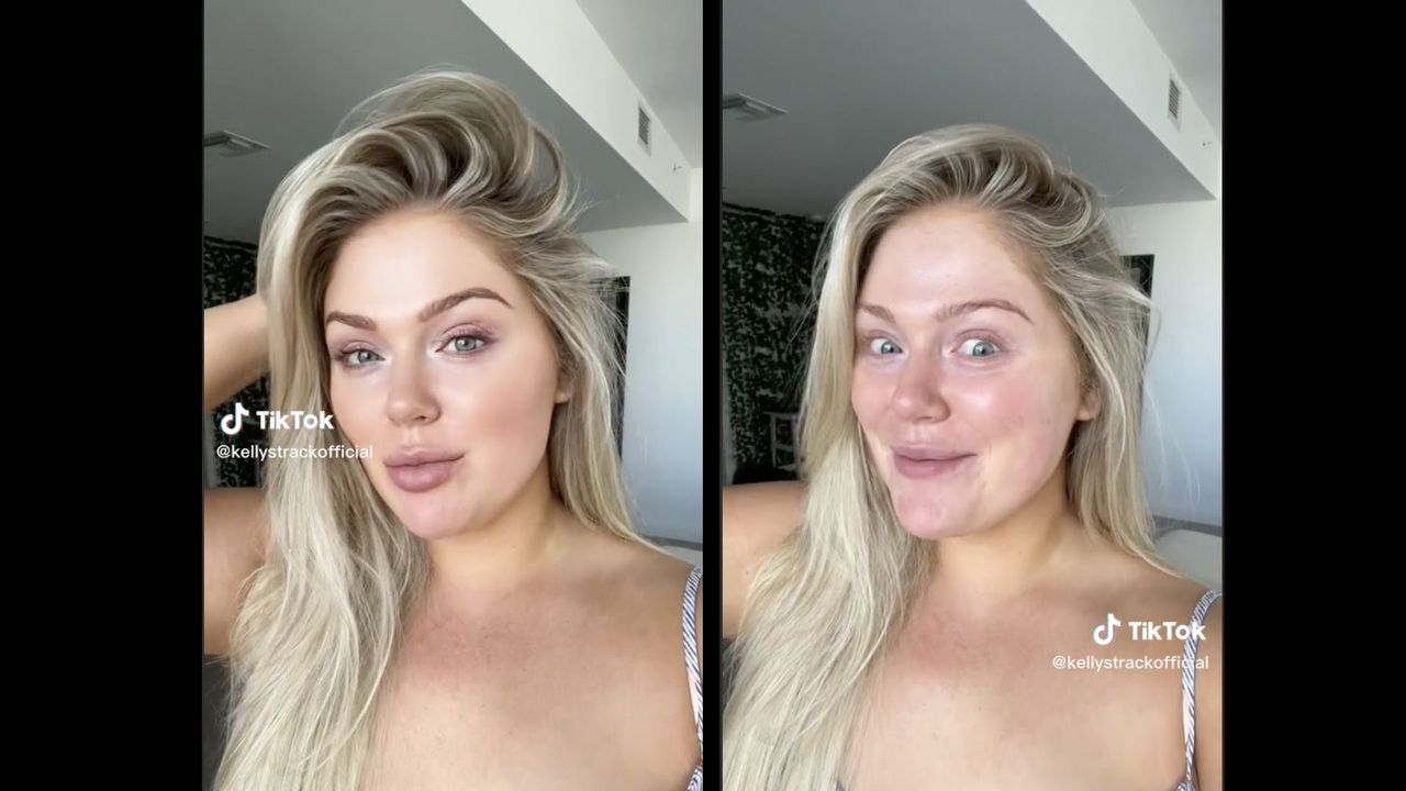 How do TikTok filters shape the latest plastic surgery trends?