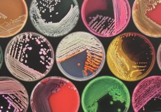 Το 19% των δαπανών υγείας αφορά ανθεκτικές λοιμώξεις