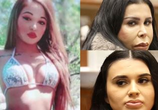 ΗΠΑ: «Φονικό» δίδυμο είχε στήσει «φάμπρικα» πλαστικών εγχειρήσεων – Νεκρή πορνοστάρ μετά από επέμβαση