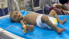 Live: Εξάχρονο παιδί πέθανε από ασιτία στη Γάζα – Μόνο 10 νοσοκομεία λειτουργούν και αυτά εν μέρει, λέει ο ΠΟΥ