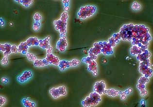 Παγκόσμια απειλή οι λοιμώξεις από ανθεκτικούς μύκητες