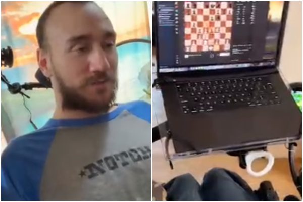 Έλον Μασκ: Άνδρας με εμφύτευμα της Neuralink παίζει σκάκι μόνο με τη σκέψη