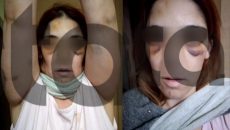 Άργος: Σοκάρει η περιγραφή της 32χρονης για τον άγριο ξυλοδαρμό από τον σύζυγό της