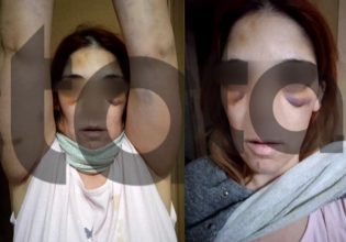 Άργος: Σοκάρει η περιγραφή της 32χρονης για τον άγριο ξυλοδαρμό από τον σύζυγό της