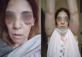 Άργος: «Με έπνιγε με μαξιλαροθήκη, μου έβαζε μαχαίρι στο λαιμό» – Παγώνουν το αίμα οι περιγραφές της 32χρονης