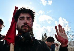 Σύνταγμα: Υπέρμετρη αστυνομική βία στο Σύνταγμα – Επεισόδια και τραυματίες φοιτητές