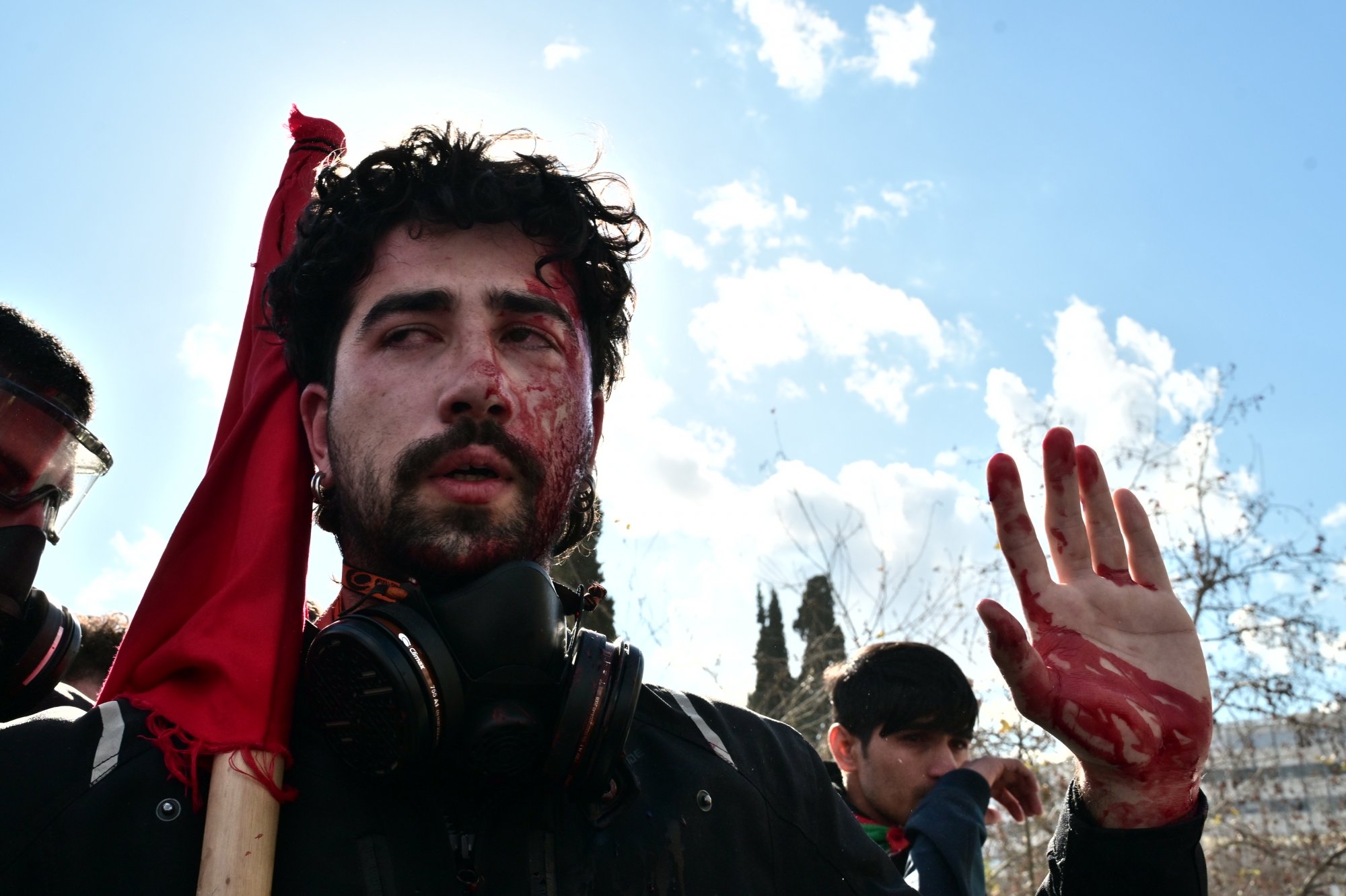 Σύνταγμα: Υπέρμετρη αστυνομική βία στο Σύνταγμα - Επεισόδια και τραυματίες φοιτητές