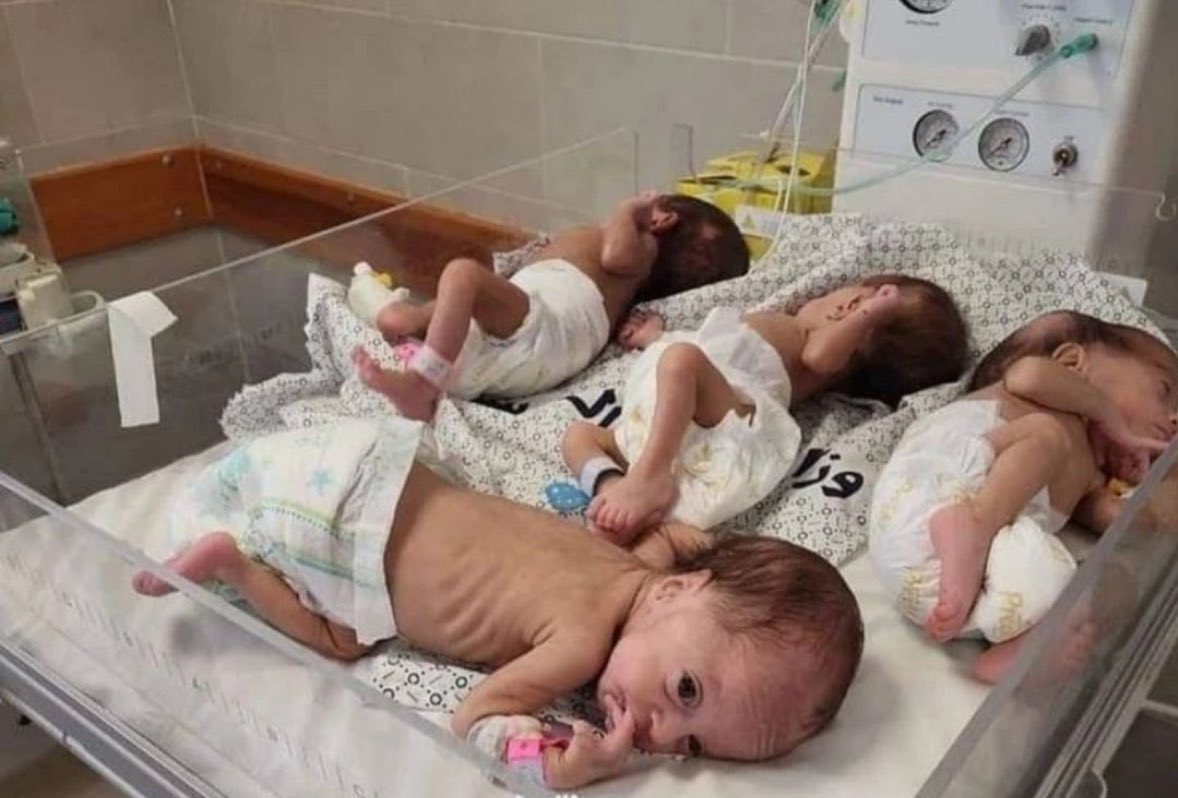 Γάζα: Οι γιατροί δεν βλέπουν πλέον «μωρά φυσιολογικού μεγέθους» - Φρικιαστικές περιγραφές από τον ΟΗΕ