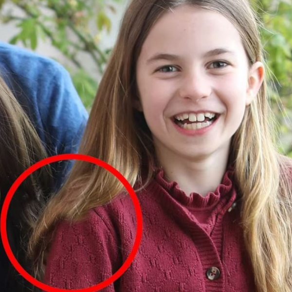 Οι αλλοιώσεις στη φωτογραφία της Κέιτ Μίντλετον