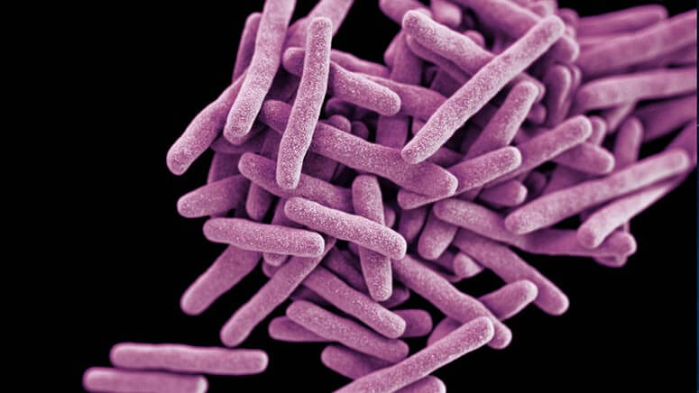 Nέα ευρήματα για τη φυματίωση - Μπορεί να μεταδοθεί με την αναπνοή