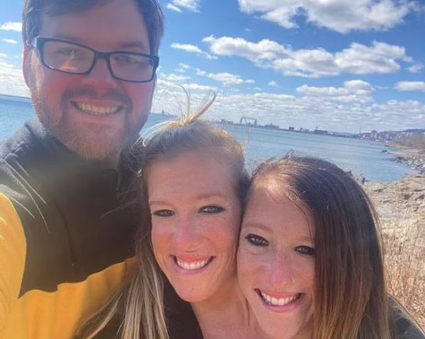 Είναι οι πιο διάσημες σιαμαίες στον κόσμο – Η μία παντρεύτηκε