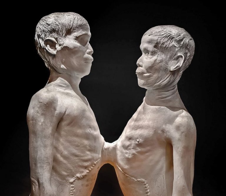 Τι γίνεται όταν ένας σιαμαίος διαπράττει έγκλημα αλλά ο αδερφός του είναι αθώος;