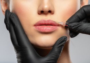 Botox: Διευκρινίσεις σχετικά με την εφαρμογή του – Ποιες ειδικότητες γιατρών πρέπει να εμπιστεύεστε