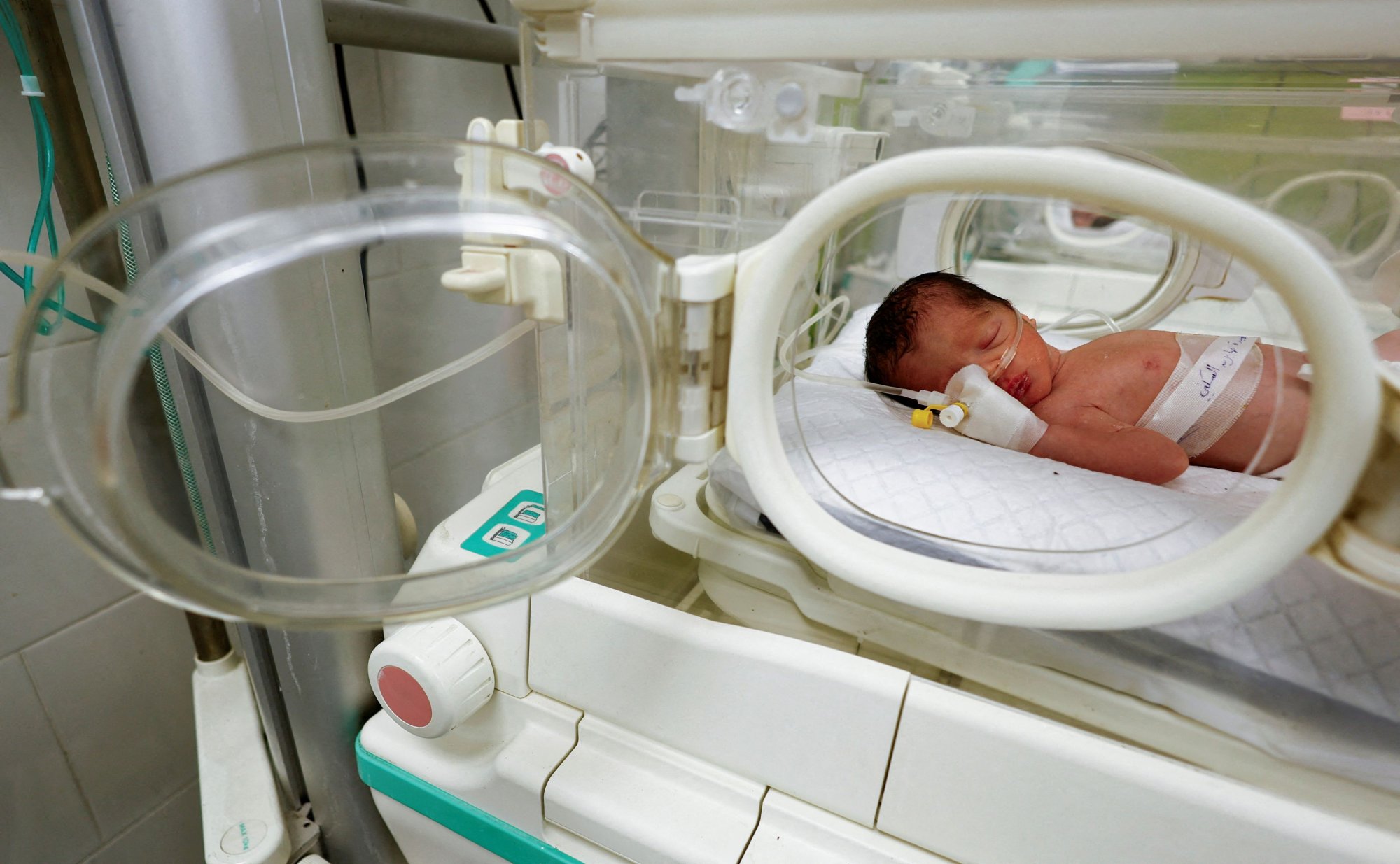 Γάζα: Μωρό γεννήθηκε πρόωρα με καισαρική ορφανό και από τους δύο γονείς
