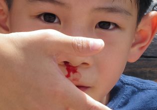 Νέες γονιδιακές θεραπείες μετασχηματίζουν την αιμορροφιλία