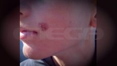 Πέλλα: Ακραίο bullying σε 14χρονο – Έσβηναν συχνά τσιγάρα πάνω του, είχαν προσπαθήσει να τον πνίξουν με ζακέτα
