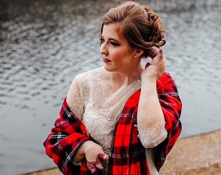 Τέξας: Γυναίκα γεννήθηκε με πρησμένα χέρια – Η εξαιρετικά σπάνια πάθηση που πλήττει 200 άτομα παγκοσμίως